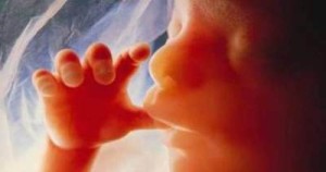 unborn child abortion